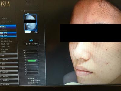皮膚檢測(cè)儀哪家強(qiáng)？Visia、美圖宜膚、A-one實(shí)測(cè)深度對(duì)比